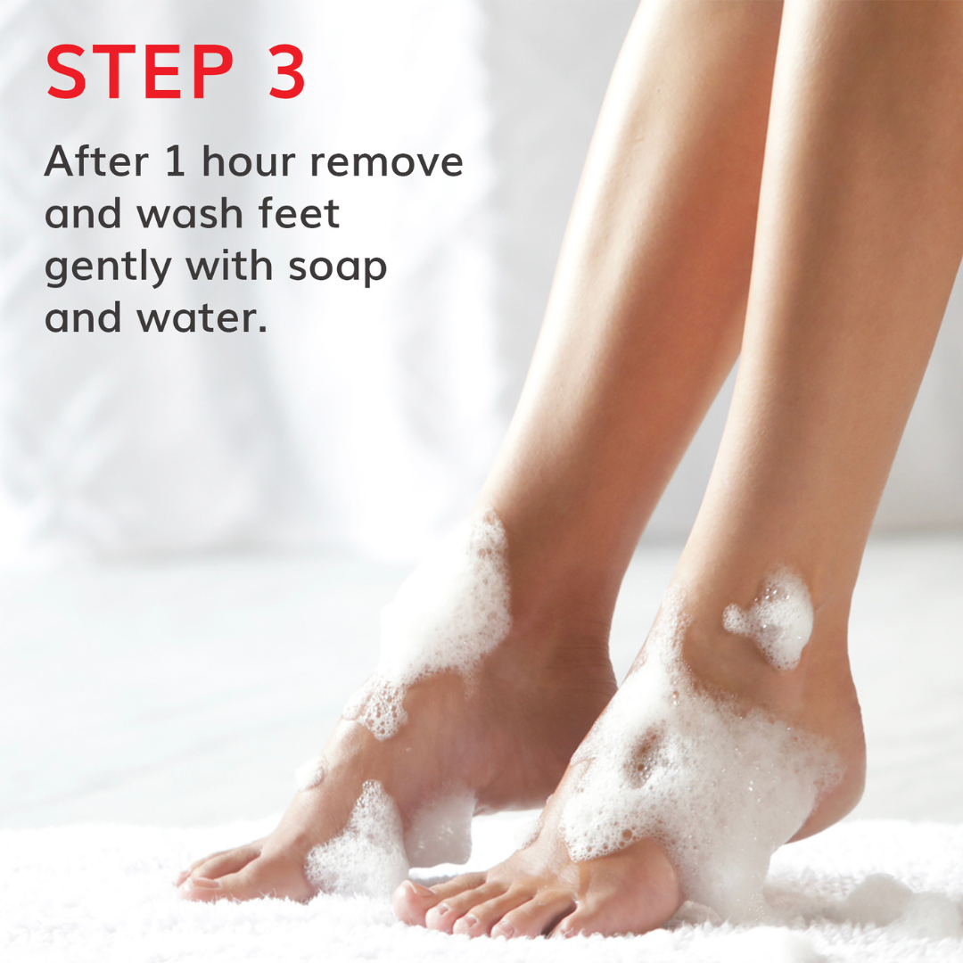 Original Exfoliation Foot Peel