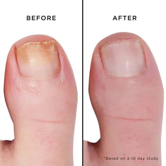 Fashion Size Mellow the Yellow Nail Brightening Treatment