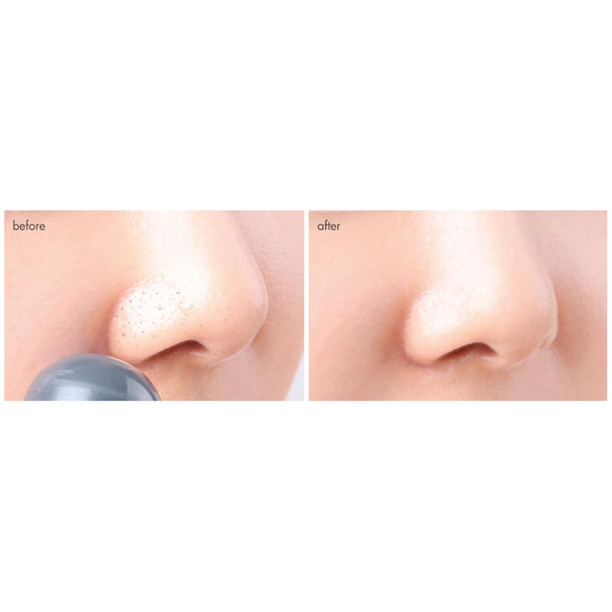 Tako Pore Blackhead Scrub Stick